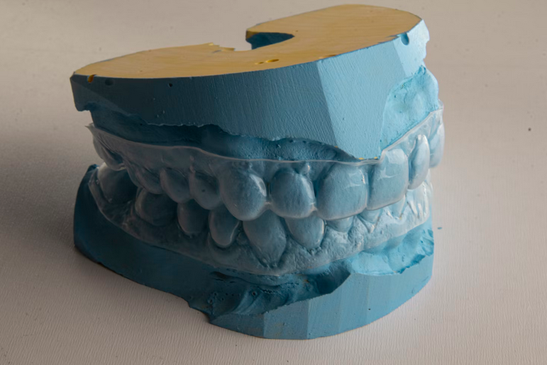 aligner